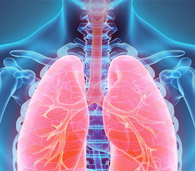 Pneumonie : un programme de recherche pour comprendre le rôle du microbiome respiratoire