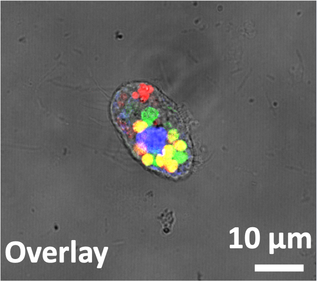 A lipid-remodeled prey is more susceptible to ciliate digestion inside the phagolysosome